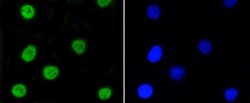 Nrf2, p Ser40 Antibody (SU0334), Novus Biologicals 100&mu;L:Antibodies,
